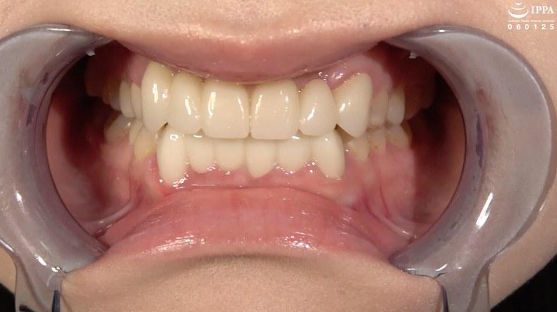 【琥珀やや】 【歯・口腔フェチ】「超敏感女優 琥珀ややちゃんの口内観察＆巨大女フェチ」WAKA-077琥珀やや